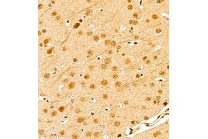 Immunohistochemistry of paraffin embedded mouse brain using scr3 (ABIN7074886) at dilution of 1:1000 (400x lens) (NCOA3 antibody)