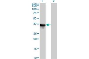 Western Blot analysis of SULT1E1 expression in transfected 293T cell line by SULT1E1 MaxPab polyclonal antibody. (SULT1E1 antibody  (AA 1-294))