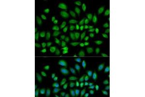 Immunofluorescence analysis of HeLa cells using PDE4D Polyclonal Antibody (PDE4D antibody)