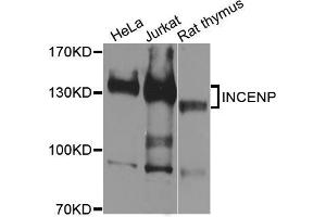 Western blot analysis of extracts of various cell lines, using INCENP antibody (ABIN5996452) at 1/1000 dilution. (INCENP antibody)