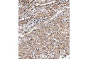 Immunohistochemical analysis of (ABIN391585 and ABIN2841517) on paraffin-embedded Human kidney tissue. (TECPR1 antibody  (C-Term))