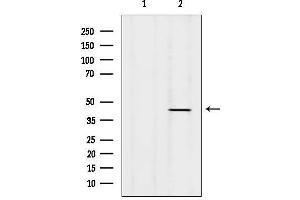 anti-Speckle-Type POZ Protein (SPOP-B) (Internal Region) antibody