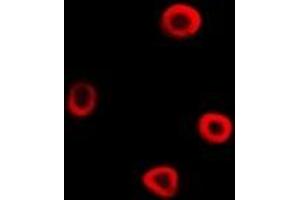 Immunofluorescent analysis of IRSp53 staining in A549 cells. (BAIAP2 antibody)