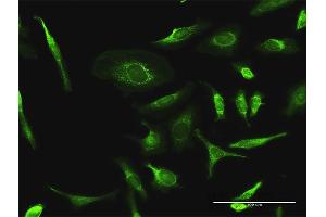 Immunofluorescence of purified MaxPab antibody to PDHA2 on HeLa cell. (PDHA2 antibody  (AA 1-388))