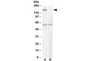 Western blot testing of human EBV-immortilized lymphoblastoid lysate with SIPA1 antibody at 1ug/ml, with (B) and without (A) immunizing peptide.