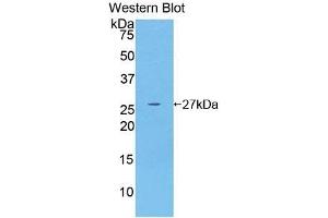 Detection of Recombinant GSTm4, Human using Polyclonal Antibody to Glutathione S Transferase Mu 4 (GSTm4) (GSTM4 antibody  (AA 18-215))