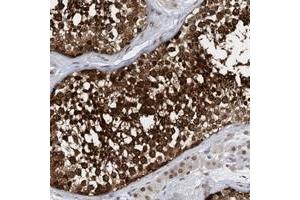 Immunohistochemical staining of human testis with KPNB1 polyclonal antibody  shows strong nuclear and cytoplasmic positivity in cells in seminiferus ducts at 1:10-1:20 dilution. (KPNB1 antibody)