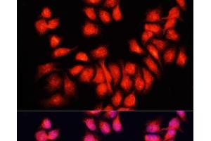 Immunofluorescence analysis of HeLa cells using BMP6 Polyclonal Antibody at dilution of 1:100. (BMP6 antibody)