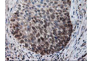 Image no. 5 for anti-Dihydrolipoamide Dehydrogenase (DLD) antibody (ABIN1497846) (DLD antibody)