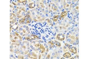 Immunohistochemistry (Paraffin-embedded Sections) (IHC (p)) image for anti-Protein Kinase, AMP-Activated, gamma 1 Non-Catalytic Subunit (PRKAG1) antibody (ABIN7263301)