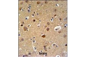 TELO2 Antibody (C-term) (ABIN651003 and ABIN2840034) IHC analysis in formalin fixed and paraffin embedded brain tissue followed by peroxidase conjugation of the secondary antibody and DAB staining.