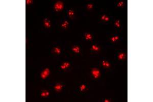 Immunofluorescent analysis of CDYL2 staining in HepG2 cells. (CDYL2 antibody  (N-Term))