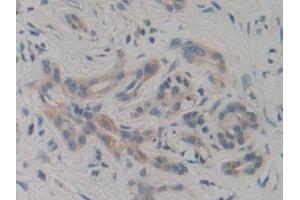 Immunohistochemistry (IHC) image for anti-Phosphoinositide-3-Kinase, Class 3 (PIK3C3) (AA 631-885) antibody (ABIN7443278)