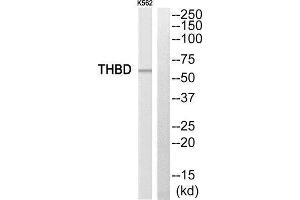 Western Blotting (WB) image for anti-Thrombomodulin (THBD) (C-Term) antibody (ABIN1852276) (Thrombomodulin antibody  (C-Term))