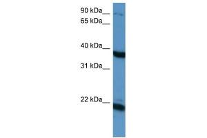 WB Suggested Anti-PTN Antibody Titration: 0. (Pleiotrophin antibody  (C-Term))