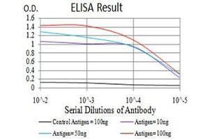 Black line: Control Antigen (100 ng), Purple line: Antigen(10 ng), Blue line: Antigen (50 ng), Red line: Antigen (100 ng), (HDAC4 antibody  (AA 456-592))