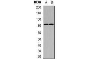 Western blot analysis of CBP80 expression in Hela (A), NIH3T3 (B) whole cell lysates. (NCBP1 antibody  (N-Term))