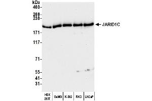 anti-Lysine (K)-Specific Demethylase 5C (KDM5C) (C-Term) antibody