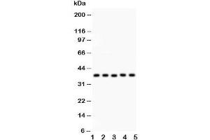 Western blot testing of KLF6 antibody and Lane 1:  human placenta;  2: rat testis;  3: (h) HeLa;  4: (h) HEPG2;  5: mouse HEPA lysate. (KLF6 antibody  (AA 38-205))