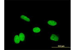Immunofluorescence of monoclonal antibody to HOXA11 on HeLa cell. (Homeobox A11 antibody  (AA 60-166))