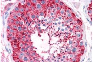 Human Testis: Formalin-Fixed, Paraffin-Embedded (FFPE) (ADAM20 antibody  (Internal Region))