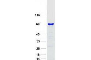 GTPase Activating Protein (SH3 Domain) Binding Protein 1 (G3BP1) (Transcript Variant 1) protein (Myc-DYKDDDDK Tag)