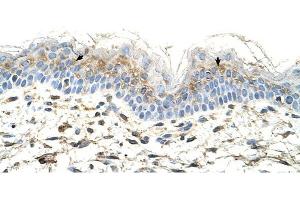 S100A3 antibody was used for immunohistochemistry at a concentration of 4-8 ug/ml to stain Squamous epithelial cells (arrows) in Human Skin.