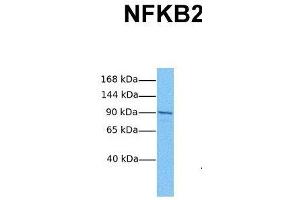 Western Blotting (WB) image for anti-Nuclear Factor of kappa Light Polypeptide Gene Enhancer in B-Cells 2 (NFKB2) (C-Term) antibody (ABIN2779436)