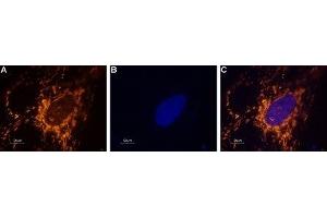 Immunocytochemistry (ICC) image for anti-Sodium Channel, Voltage-Gated, Type I, alpha Subunit (SCN1A) (AA 465-481), (Intracellular) antibody (ABIN7043638)