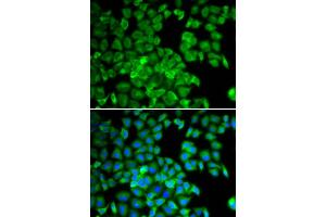 Immunofluorescence analysis of U2OS cells using TCP1 antibody. (TCP1 alpha/CCTA antibody)
