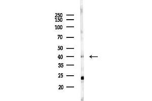 anti-Enoyl-CoA Delta Isomerase 2 (PECI) (Internal Region) antibody