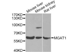 Western blot analysis of extracts of various cell lines, using MGAT1 Antibody (ABIN5975025) at 1/1000 dilution. (MGAT1 antibody)