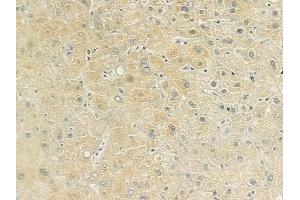 ABIN6260180 and ABIN6279191 at 1/100 staining human normal liver tissue by IHC-P. (BAAT antibody  (N-Term))