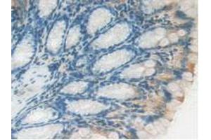 IHC-P analysis of Mouse Intestine Tissue, with DAB staining. (LAMP2 antibody  (AA 295-410))