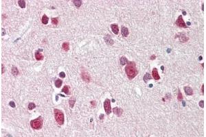 Immunohistochemistry (IHC) image for anti-Cbp/p300-Interacting Transactivator, with Glu/Asp-Rich Carboxy-terminal Domain, 2 (CITED2) (N-Term) antibody (ABIN1804228)