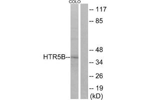 Western blot analysis of extracts from COLO cells, using HTR5B antibody. (HTR5B antibody  (C-Term))