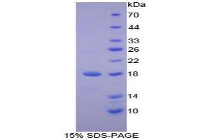 SDS-PAGE analysis of Human LTbR Protein.
