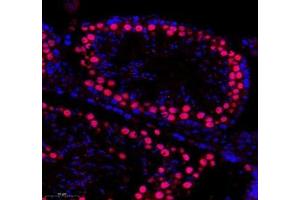 Immunofluorescence of paraffin embedded mouse testis using SLBP (ABIN7075733) at dilution of 1: 650 (300x lens) (SLBP antibody)