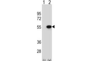 Western Blotting (WB) image for anti-Reptin,TIP49B,RUVB2 antibody (ABIN2995224) (Reptin,TIP49B,RUVB2 antibody)