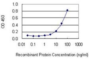 Detection limit for recombinant GST tagged SP140 is 0. (SP140 antibody  (AA 504-612))