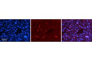 Rabbit Anti-ZNF3 Antibody      Formalin Fixed Paraffin Embedded Tissue: Human Adult Liver   Observed Staining: Nuclear in hepatocytes, moderate signal, low tissue distribution  Primary Antibody Concentration: 1:100  Secondary Antibody: Donkey anti-Rabbit-Cy3  Secondary Antibody Concentration: 1:200  Magnification: 20X  Exposure Time: 0. (ZNF3 antibody  (N-Term))