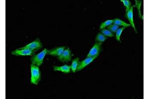 Immunofluorescent analysis of Hela cells using ABIN7153285 at dilution of 1:100 and Alexa Fluor 488-congugated AffiniPure Goat Anti-Rabbit IgG(H+L) (KCNJ3 antibody  (AA 350-487))
