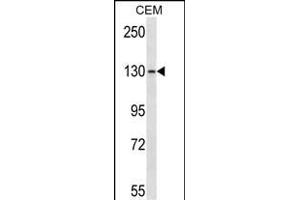 GRM1 Antibody (C-term) (ABIN657624 and ABIN2846620) western blot analysis in CEM cell line lysates (35 μg/lane). (Metabotropic Glutamate Receptor 1 antibody  (C-Term))