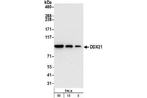 Western Blotting (WB) image for anti-DEAD (Asp-Glu-Ala-Asp) Box Polypeptide 21 (DDX21) (C-Term) antibody (ABIN7450161)