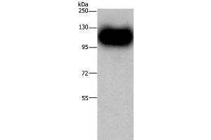 Western Blot analysis of Mouse brain tissue using MAG Polyclonal Antibody at dilution of 1:450 (MAG antibody)