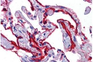Human Lung: Formalin-Fixed, Paraffin-Embedded (FFPE) (SCUBE2 antibody  (Internal Region))