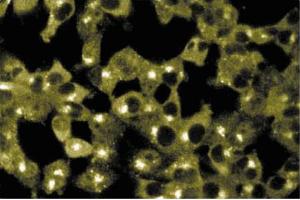 Immunofluorescence staining of ES-2 cells (Human ovary clear cell carcinoma, ATCC CRL-1978). (Sorting Nexin 2 antibody  (AA 15-137))