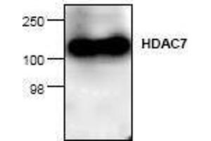 Image no. 1 for anti-Histone Deacetylase 7 (HDAC7) antibody (ABIN127244) (HDAC7 antibody)