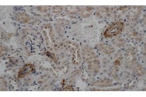 Immunohistochemistry of paraffin-embedded Mouse kidney using ACTA2 Polyclonal Antibody at dilution of 1:50 (Smooth Muscle Actin antibody)
