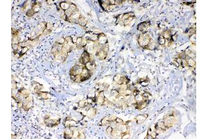 Immunohistochemistry (IHC) image for anti-UDP-Galactose-4-Epimerase (GALE) (AA 1-340) antibody (ABIN5693266)
